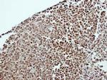 DDX23 Antibody in Immunohistochemistry (Paraffin) (IHC (P))