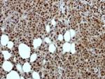 MED17 Antibody in Immunohistochemistry (Paraffin) (IHC (P))