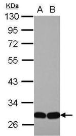 VPS26A Antibody in Western Blot (WB)