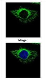 ERP72 Polyclonal Antibody