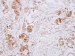GDA Polyclonal Antibody