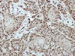 CTR9 Polyclonal Antibody