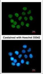 SAFB2 Polyclonal Antibody
