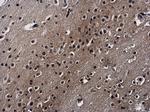 SAFB2 Antibody in Immunohistochemistry (Paraffin) (IHC (P))