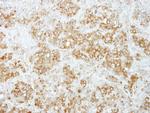 PUM1 Antibody in Immunohistochemistry (Paraffin) (IHC (P))