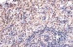 TOX Antibody in Immunohistochemistry (Paraffin) (IHC (P))