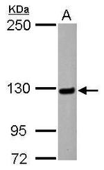 MATR3 Polyclonal Antibody