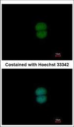 RNF40 Polyclonal Antibody