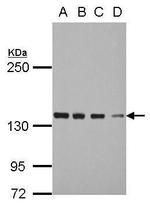 DDX46 Antibody in Western Blot (WB)
