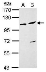 DDX46 Antibody in Western Blot (WB)