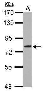GFPT2 Polyclonal Antibody