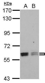 PTBP3 Polyclonal Antibody