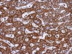 TOM1L1 Polyclonal Antibody