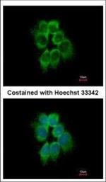 p41-ARCb Polyclonal Antibody
