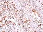 ACTR1A Polyclonal Antibody
