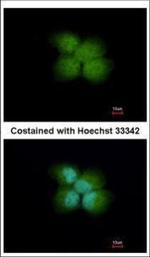 RNF41 Polyclonal Antibody