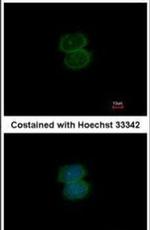 PRMT3 Antibody in Immunocytochemistry (ICC/IF)