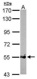 PRMT3 Antibody in Western Blot (WB)