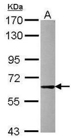 PRMT3 Antibody in Western Blot (WB)