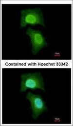 MPHOSPH6 Polyclonal Antibody