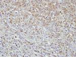 MPHOSPH6 Antibody in Immunohistochemistry (Paraffin) (IHC (P))