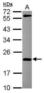MPHOSPH6 Antibody in Western Blot (WB)