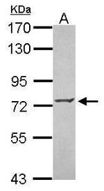 ZNF443 Polyclonal Antibody