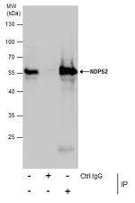 CALCOCO2 Antibody in Immunoprecipitation (IP)