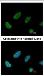 BCAS2 Polyclonal Antibody