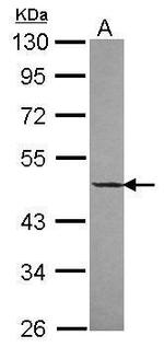 DNAJA2 Polyclonal Antibody