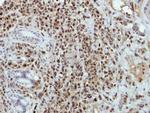 BRAF35 Polyclonal Antibody