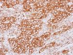 Tubulin beta-2C Polyclonal Antibody