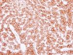 Tubulin beta-2C Antibody in Immunohistochemistry (Paraffin) (IHC (P))