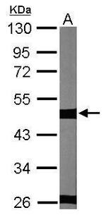 Tubulin beta-2C Antibody in Western Blot (WB)