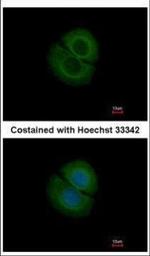 Coronin 2B Polyclonal Antibody