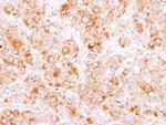 Coronin 2B Antibody in Immunohistochemistry (Paraffin) (IHC (P))