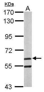 ARIH2 Polyclonal Antibody