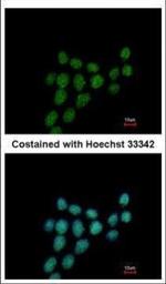 PIBF1 Polyclonal Antibody