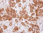 Dynactin 2 Antibody in Immunohistochemistry (Paraffin) (IHC (P))