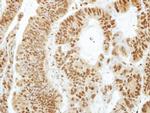 PHAPI2 Polyclonal Antibody