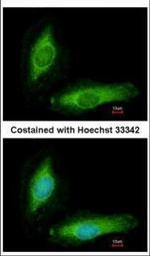 SCGN Polyclonal Antibody