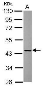 RAD51AP1 Polyclonal Antibody