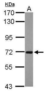 RGS14 Polyclonal Antibody