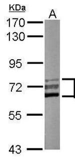 CaMKK beta Antibody in Western Blot (WB)