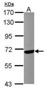 CaMKK beta Antibody in Western Blot (WB)