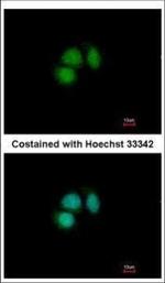 CUG-BP2 Polyclonal Antibody