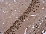 CUG-BP2 Antibody in Immunohistochemistry (Paraffin) (IHC (P))
