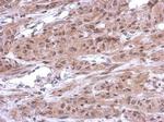CUG-BP2 Antibody in Immunohistochemistry (Paraffin) (IHC (P))