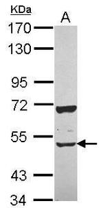 CUG-BP2 Antibody in Western Blot (WB)