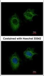 MTHFD2 Polyclonal Antibody